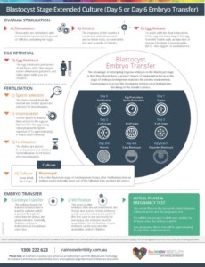 IVF Blastocyst Culture Information Guide: Step by step