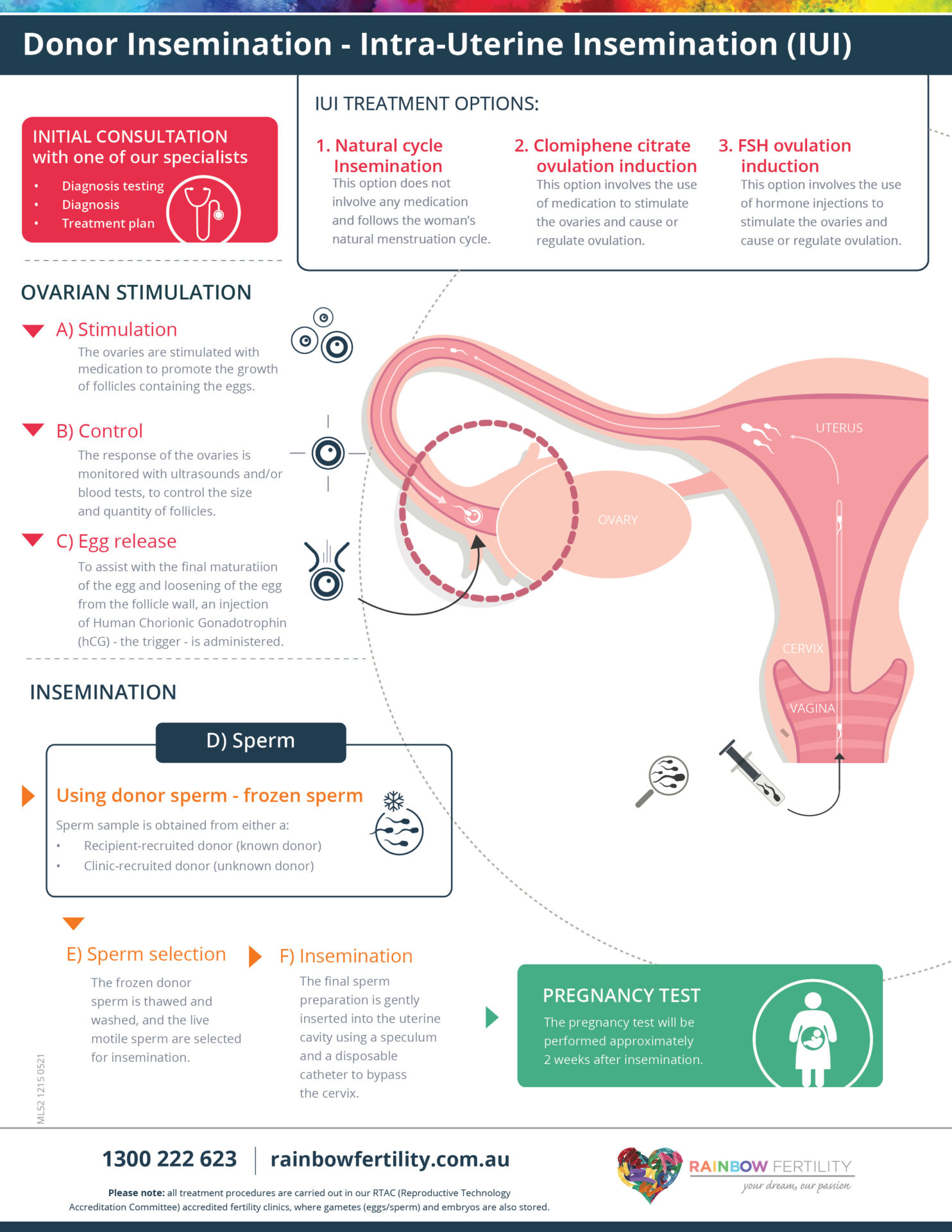 Ml52 Rainbow Fertility Donor Insemination Infographic Rainbow Fertility